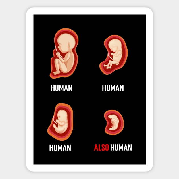 Even a Fetus is a human....Abortion choice Quotes Magnet by Movielovermax